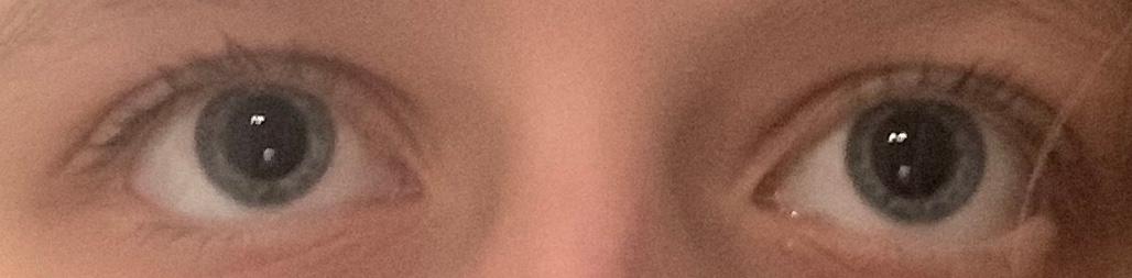 Sind meine Pupillen unterschiedlich gross? (Augen, Pupille)
