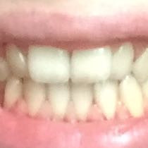 Das sind meine Zähne  - (Gesundheit und Medizin, Zähne, Zahnarzt)