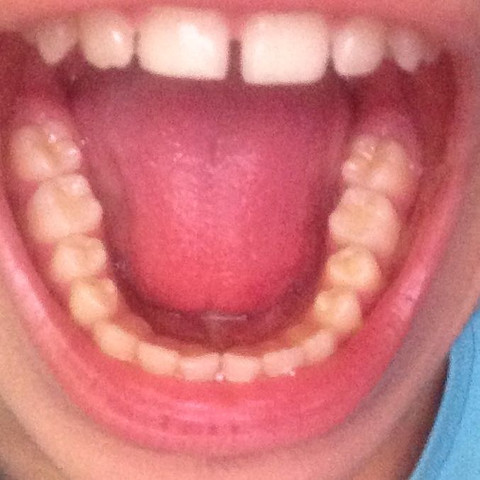 Sind Meine Zahne Nicht Mehr Zu Retten Arzt Zahnarzt Sind Meine Zahne Nicht Mehr Zu Retten Arzt Zahnarzt