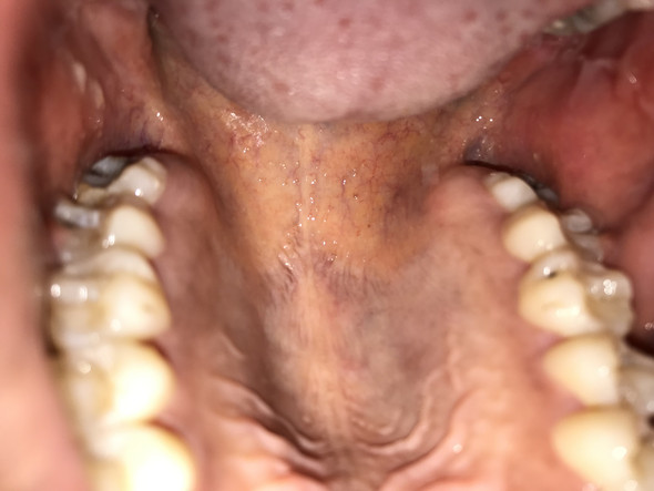 Sind Meine Zahne Noch Zu Retten Bild Zahnarzt Zahnmedizin Zahnschmerzen Sind Meine Zahne Noch Zu Retten Bild Zahnarzt Zahnmedizin Zahnschmerzen