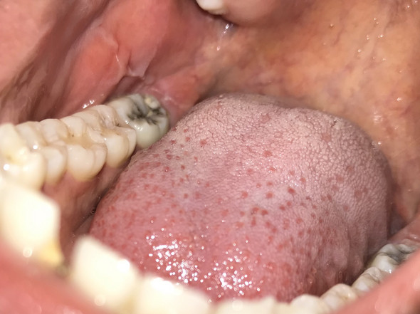 Sind Meine Zahne Noch Zu Retten Bild Zahnarzt Zahnmedizin Zahnschmerzen Sind Meine Zahne Noch Zu Retten Bild Zahnarzt Zahnmedizin Zahnschmerzen