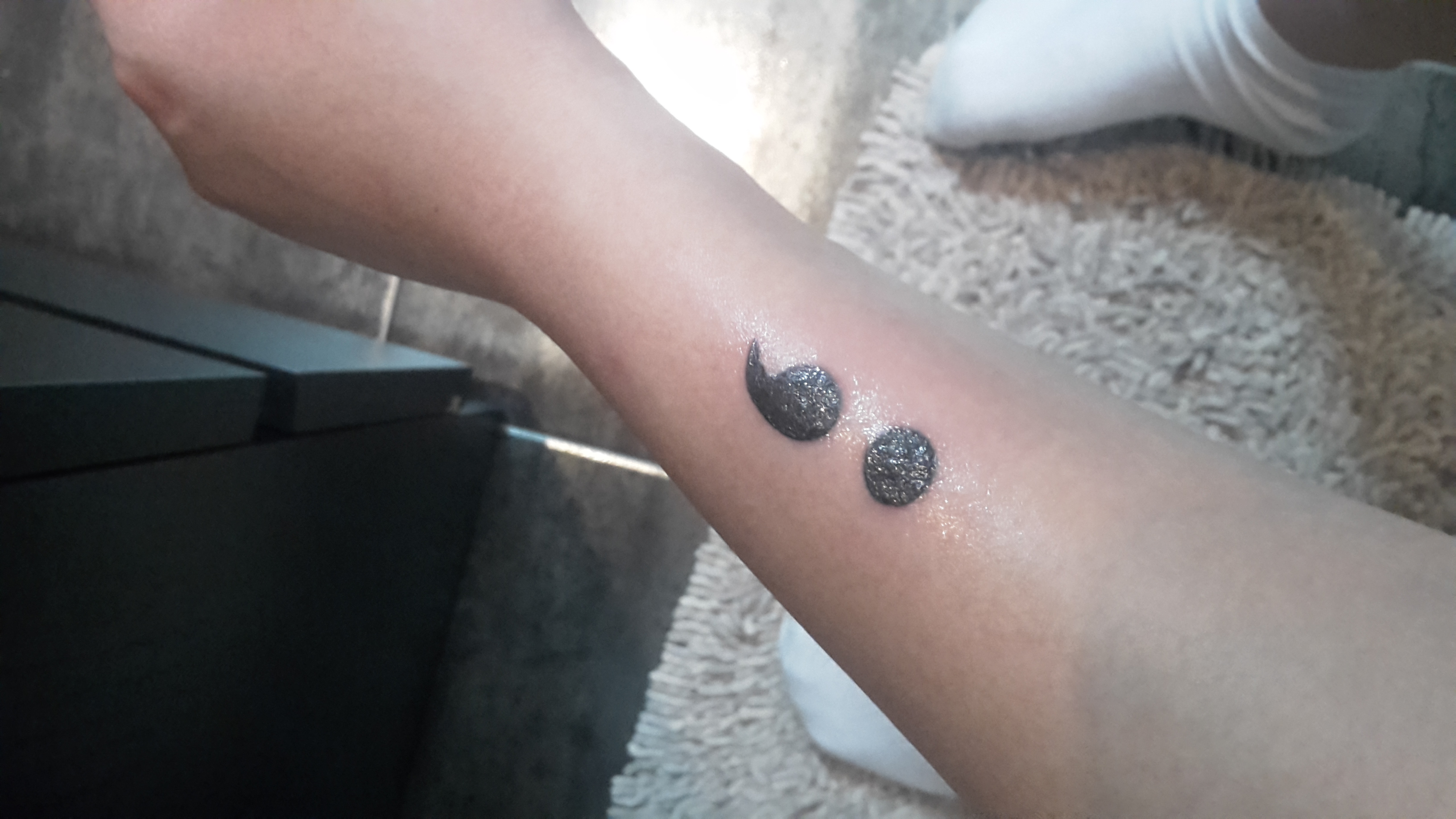 Sind Rötungen und Schwellungen bei Tattoos normal? (Pflege, Tattoo