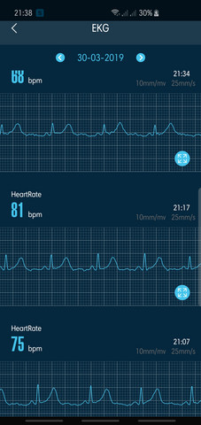 Smartwatch Und Ekg