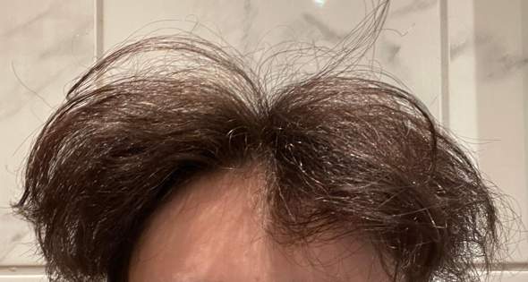 Soll ich meine Haare abrasieren und was hab ich für eine Haarstruktur?