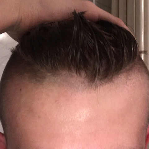 Soll Ich Mir Die Haare Abschneiden Ja Oder Nein Kopf