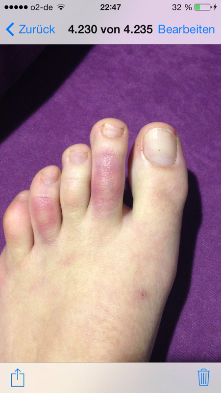 Soll ich morgen zum Arzt?!..hilfeeeee (Schmerzen, Füße, Zeh)