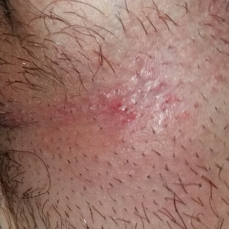 arzt gehen oder vorerst abwarten