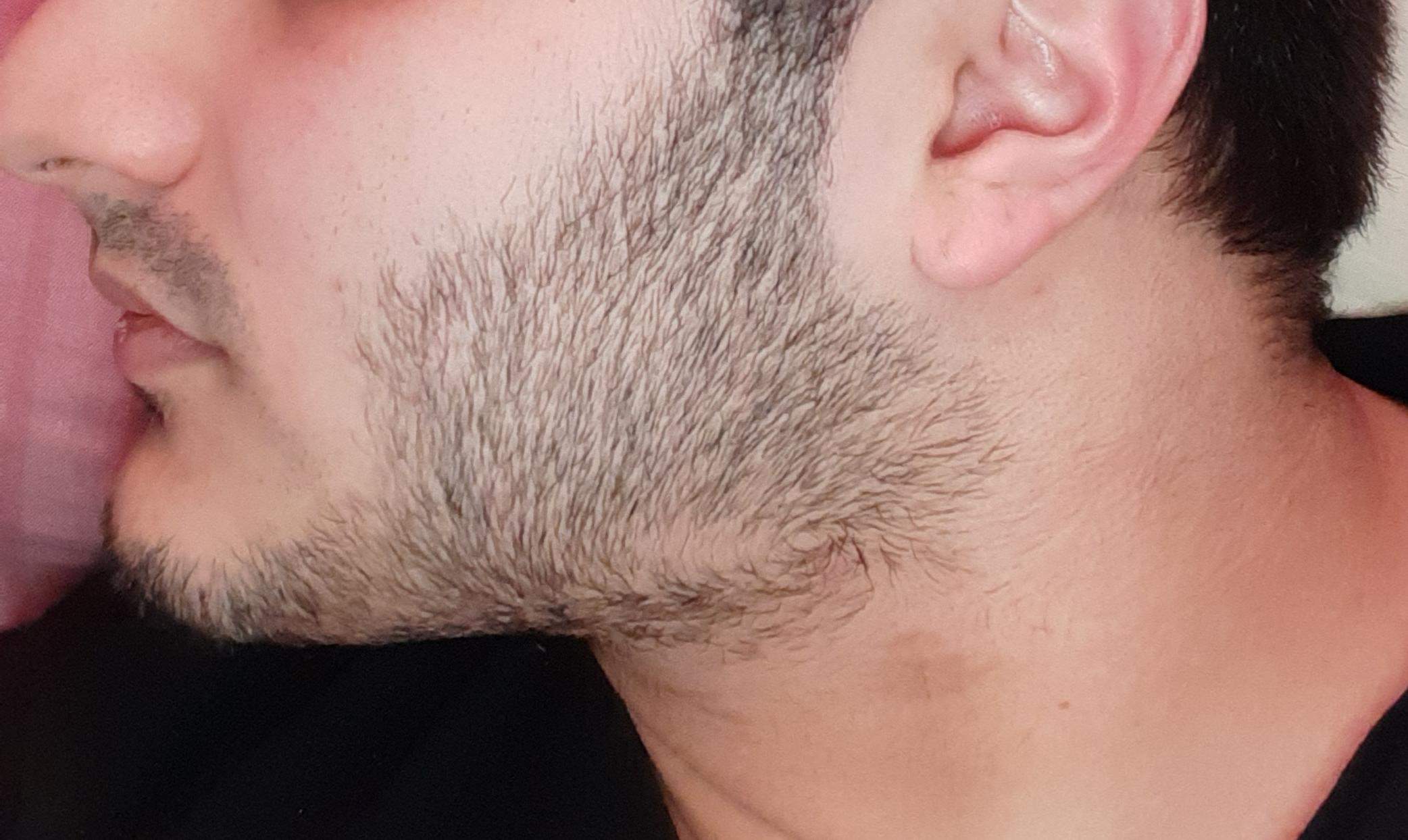 Sollte ich meinen Bart trimmen bzw. wegrasieren, oder ist er in einem