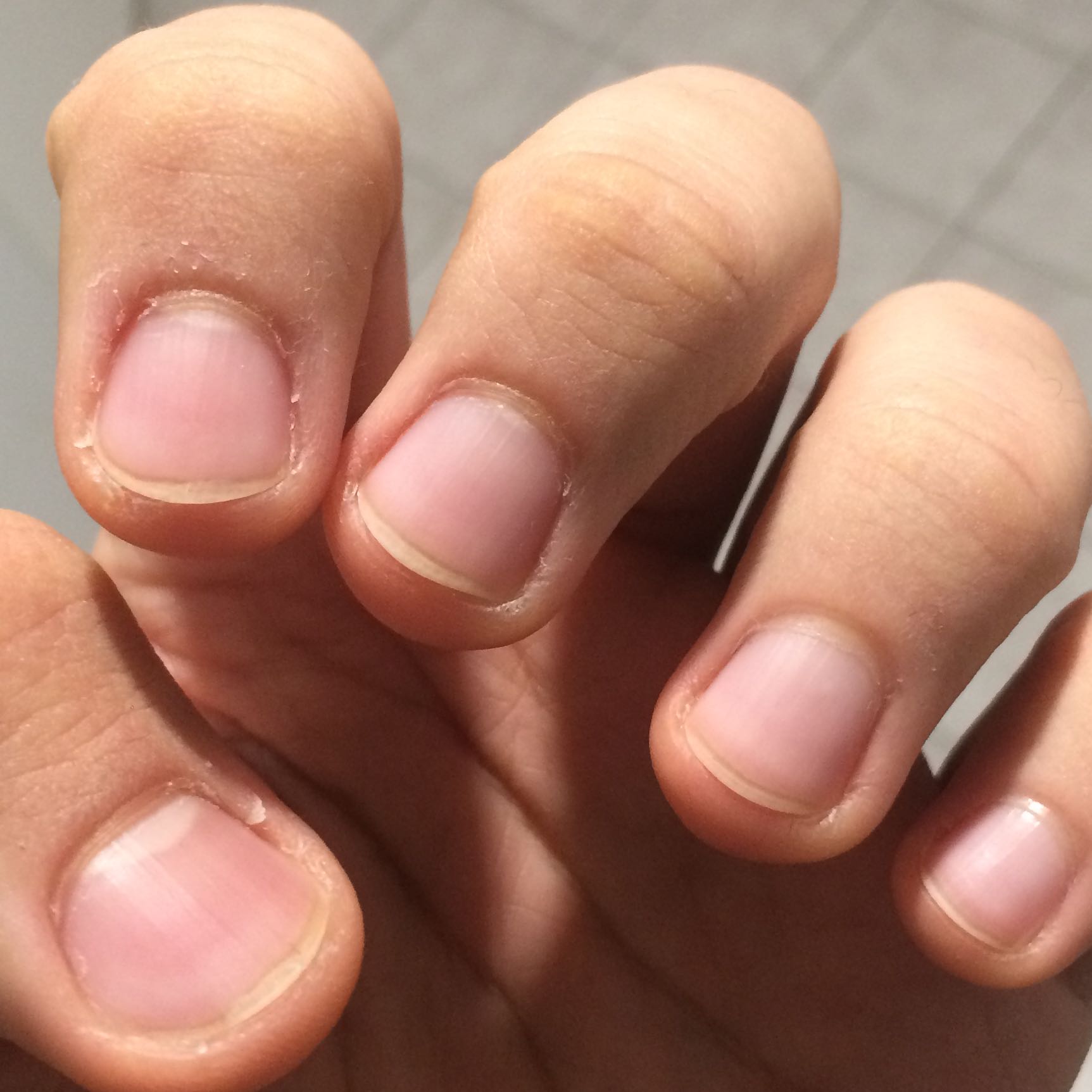 Sollte ich meinte Nägel schneiden? (Fingernägel, Lang)