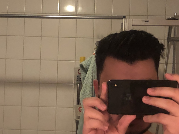 Sollte Ich Mir Sorgen Machen Geheimratsecken Haare Frisur Haarausfall