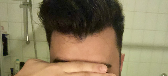 Sollte Ich Mir Sorgen Machen Geheimratsecken Haare Frisur Haarausfall