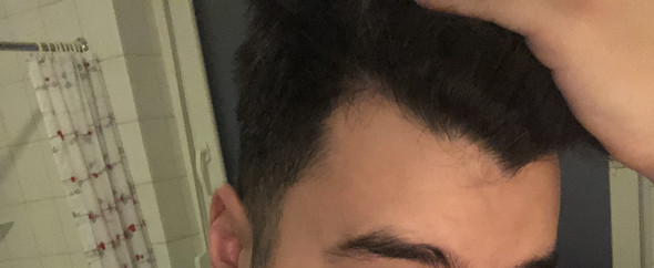 Sollte Ich Mir Sorgen Machen Geheimratsecken Haare Frisur Haarausfall