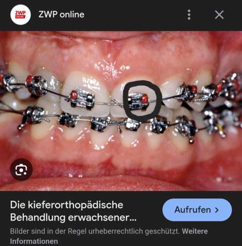 Bild zum Beitrag
