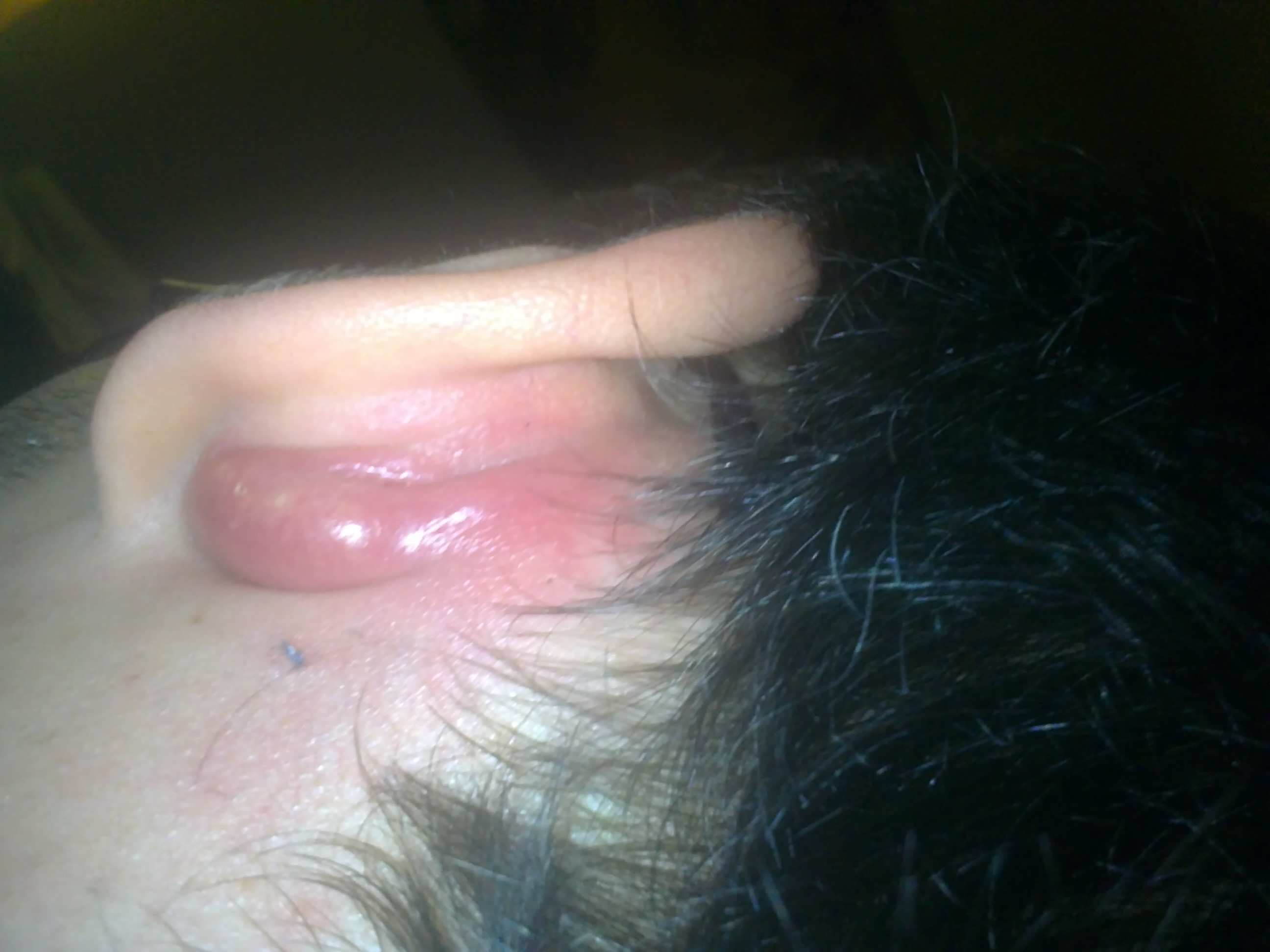 Sollte Sich Das Ein Arzt Ansehen Oder Kennt Einer So Was Gesundheit Ohr Sollte Sich Das Ein Arzt Ansehen Oder Kennt Einer So Was Gesundheit Ohr