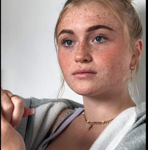 Sommersprossen mit Henna,welche Farbe?