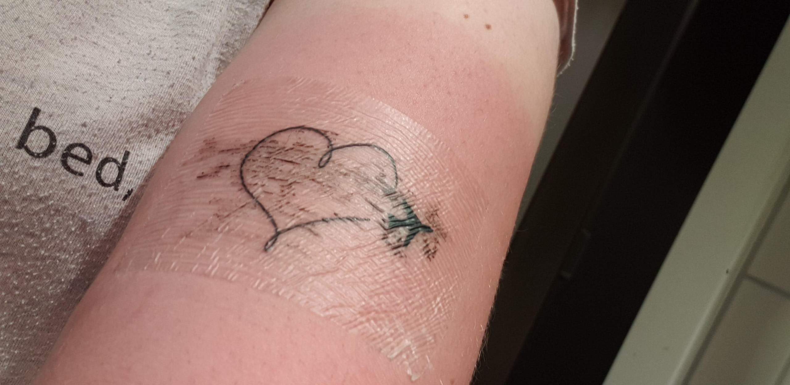 Sonnenbrand Auf Ein Tag Altes Tattoo Tattoostudio Tattoopflege Sonnenbrand Auf Ein Tag Altes Tattoo Tattoostudio Tattoopflege