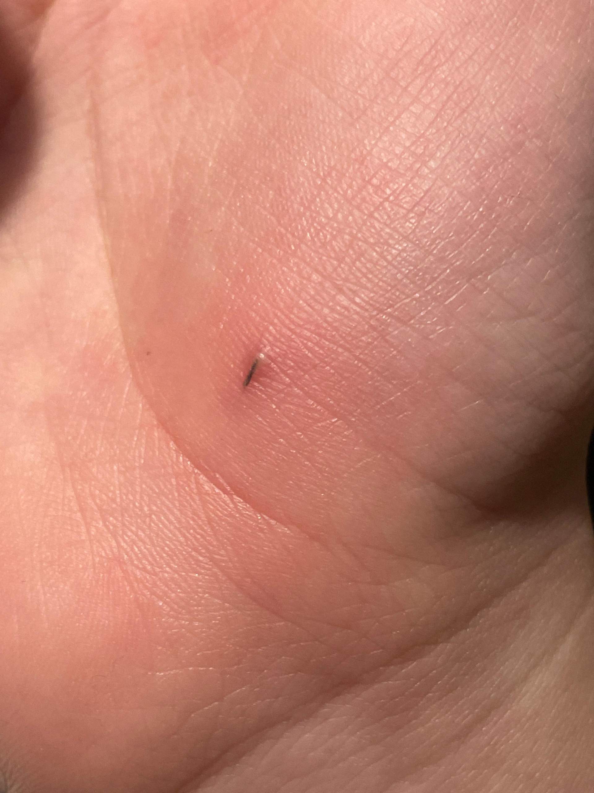 Spie in der Hand? (Gesundheit und Medizin, Gesundheit)