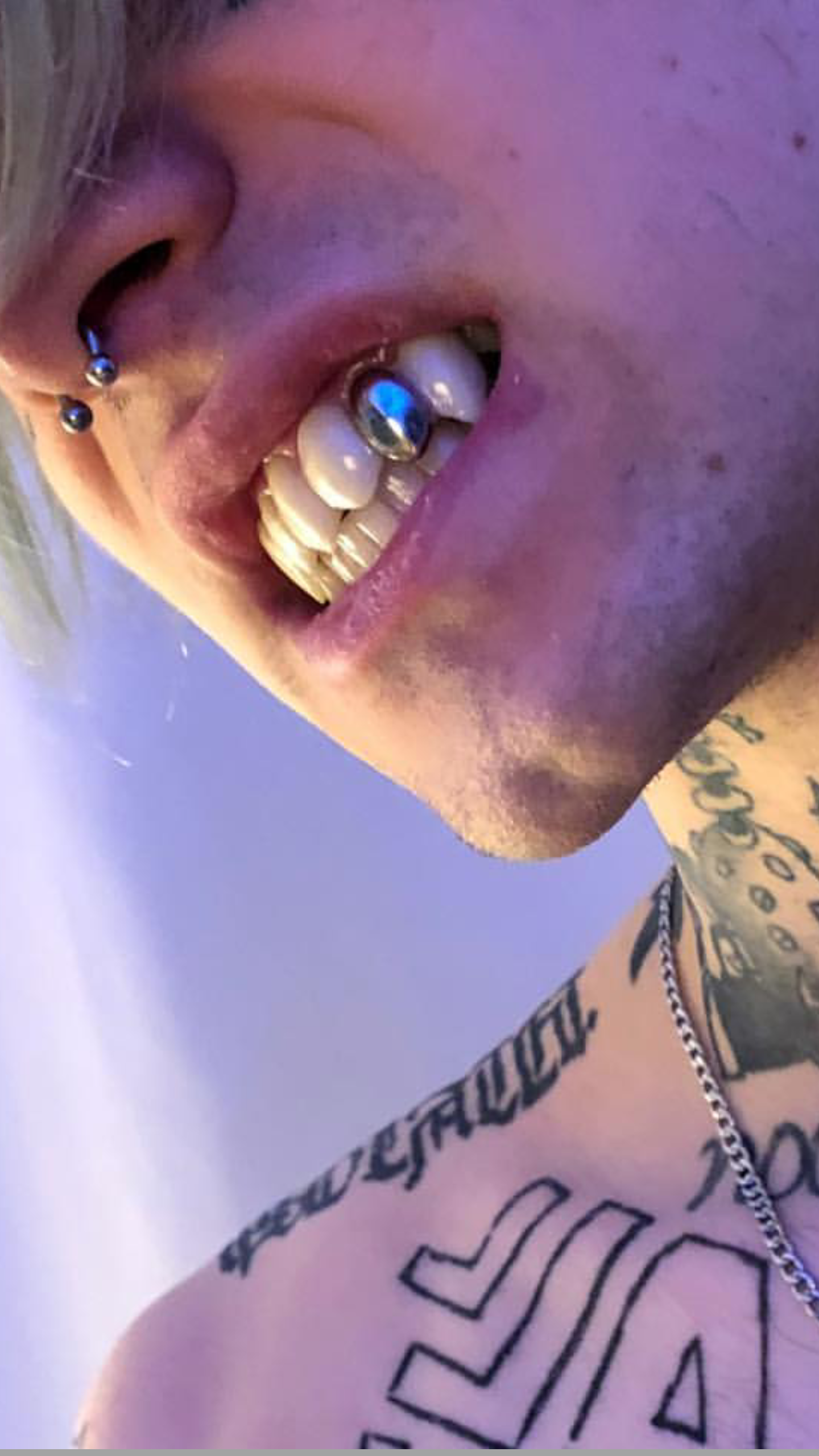 Spitze Zahnaufsatze Zahne Hip Hop Taddl