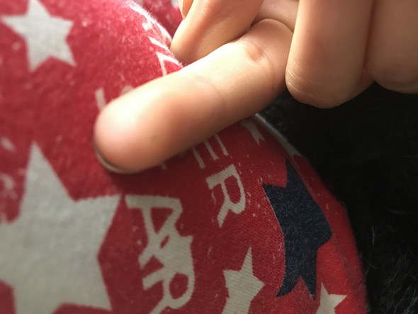 Splitter Im Finger Seit 3 Jahren Splitter Im Finger Seit 3 Jahren