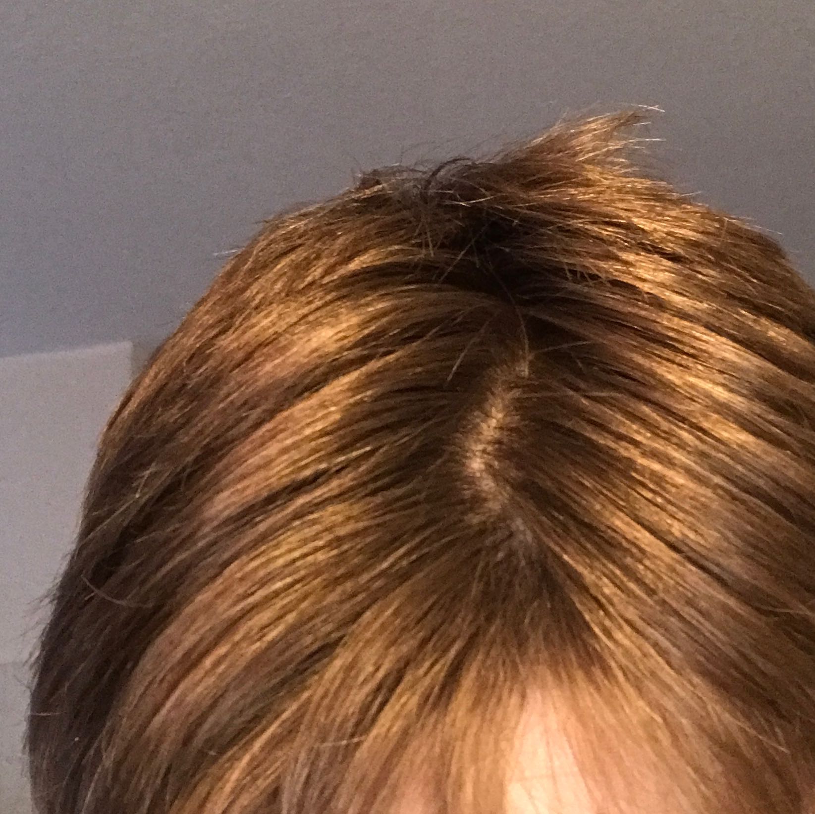 Spricht Der Scheitel Fuer Dickes Oder Duennes Haar Haare Mannlich