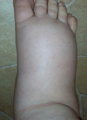 Schlimmer Fuß  - (Körper, Arzt, Wasser)