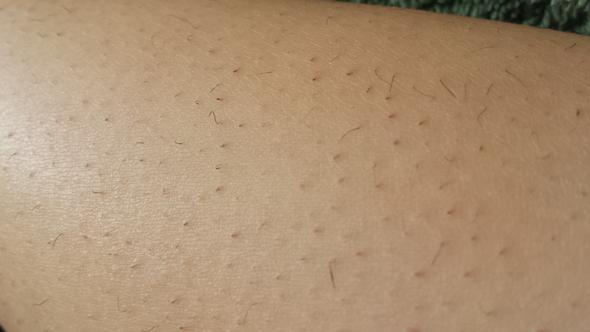 starke korperbehaarung epilieren