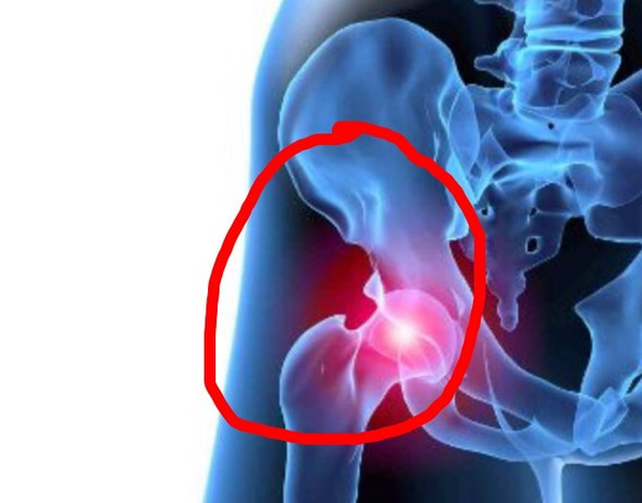 Ich Habe Nach Krafttraining Starke Schmerzen In Hufte Und Leiste Hat Jemand Erfahrung Damit Oder Hat Jemand Tipps Was Ich Machen Soll Gesundheit Korper Ich Habe Nach Krafttraining Starke Schmerzen In Hufte Und Leiste Hat Jemand Erfahrung Damit Oder Hat Jemand Tipps Was Ich Machen Soll Gesundheit Korper