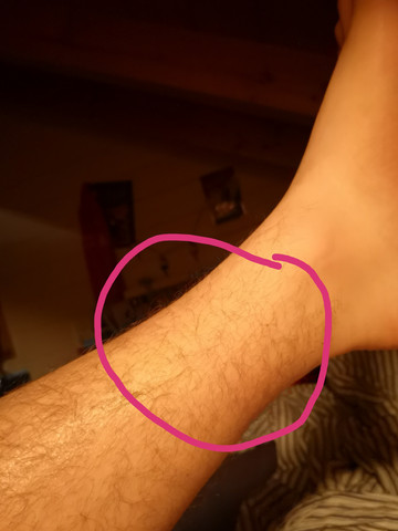 Starke Schmerzen Oberhalb Des Fussgelenk Kann Mir Jemand Helfen Gesundheit Und Medizin Sport Medizin Starke Schmerzen Oberhalb Des Fussgelenk Kann Mir Jemand Helfen Gesundheit Und Medizin Sport Medizin