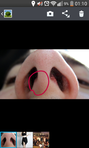 Und nase schmerzt von innen geschwollen VIDEO: Nase