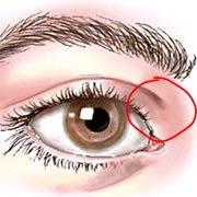 Starke Schmerzen Zwischen Auge Und Nase Augen Kopfschmerzen Starke Schmerzen Zwischen Auge Und Nase Augen Kopfschmerzen
