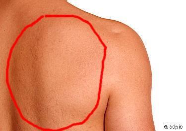 Starke Schulterschmerzen Schlusselbein Oder Nerv Geklammt Schmerzen Schulter Starke Schulterschmerzen Schlusselbein Oder Nerv Geklammt Schmerzen Schulter