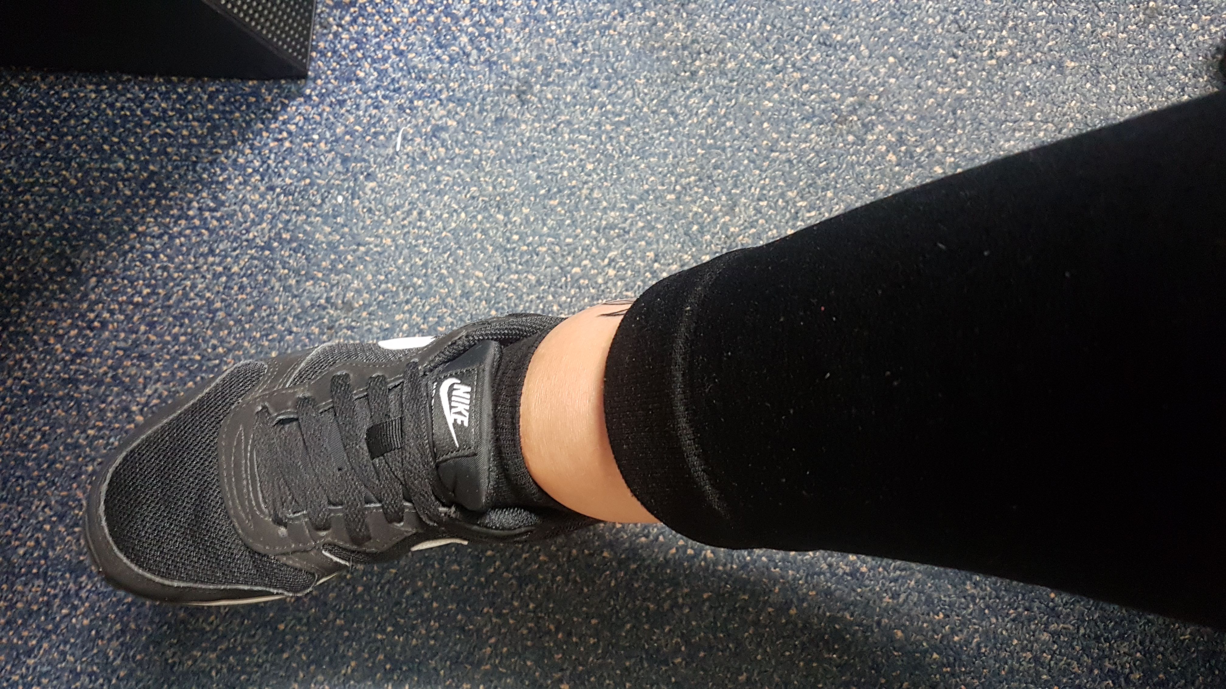 Starke Schwellung nach Tattoo?