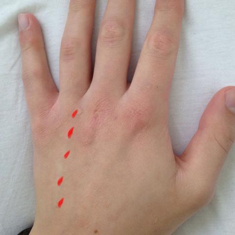 rote markierte Stellen sind die Schmerzen - (Schmerzen, Hand, stechen)