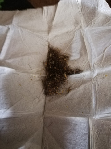 Starke Talgproduktion Ausfallende Augenbrauen Und Wimpern Haarausfall