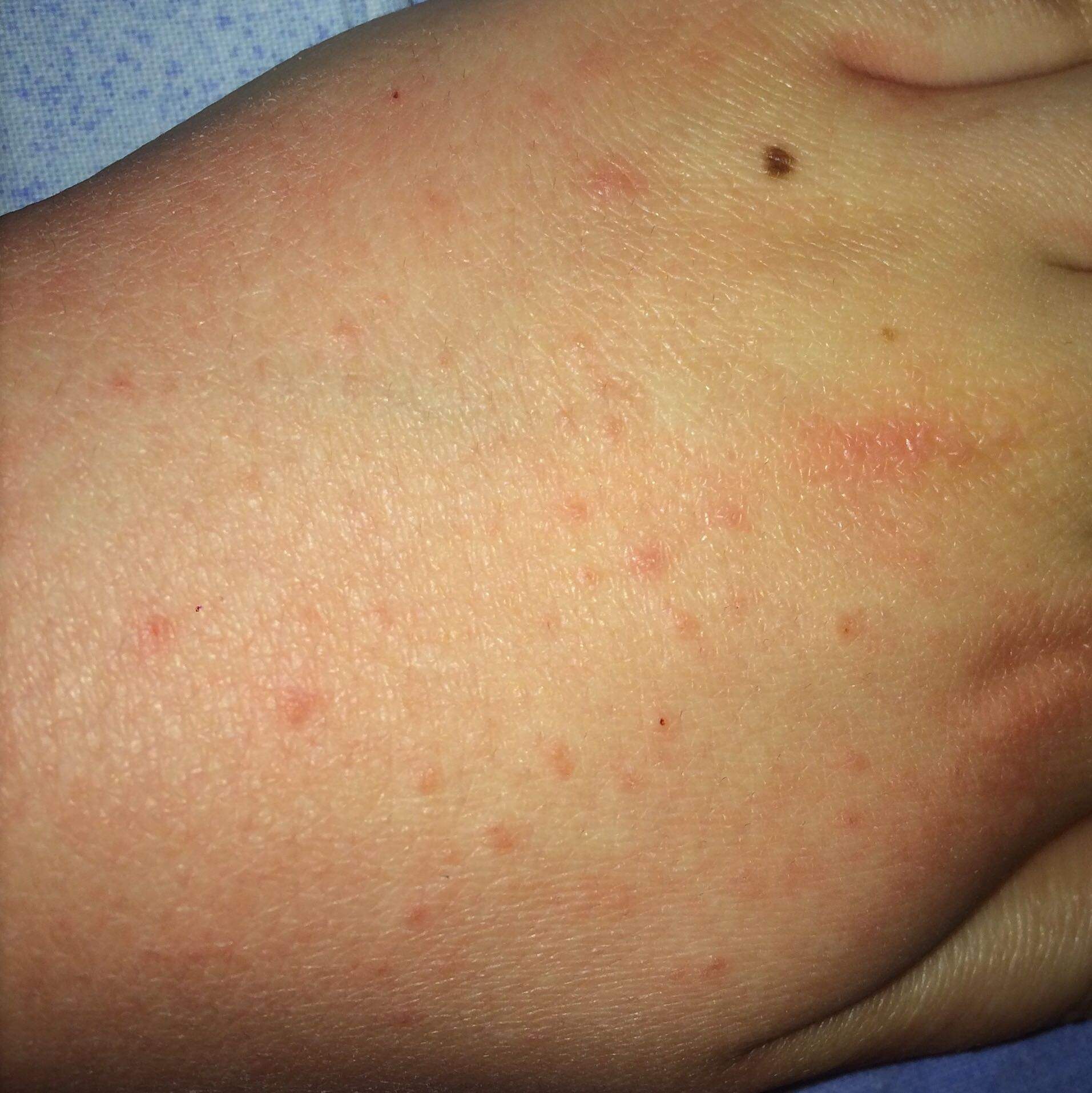 Starker Juckreiz und komische rote Flecken