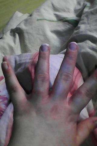 hand3 - (Gesundheit, Krankheit, Haut)