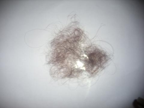 Starkes Haarausfall Mit 16 Gesundheit Haare Starkes Haarausfall Mit 16 Gesundheit Haare