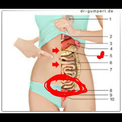 Unterbauch schmerzen rechter Unterleibsschmerzen