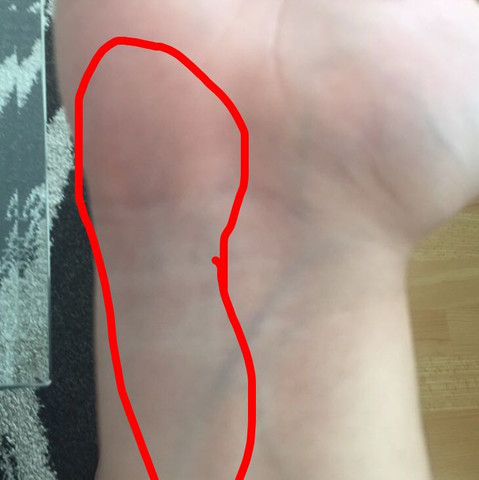 Stechende Starke Schmerzen Im Handgelenk Gesundheit Medizin Stechende Starke Schmerzen Im Handgelenk Gesundheit Medizin