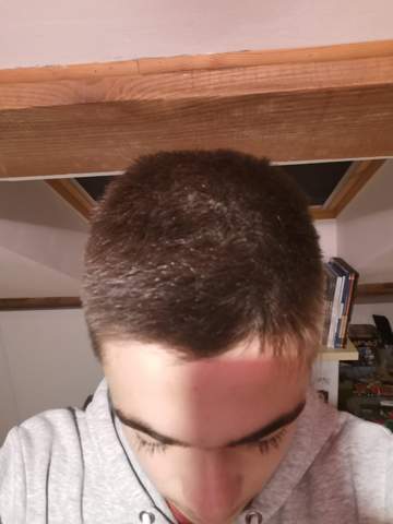 Bild zum Beitrag