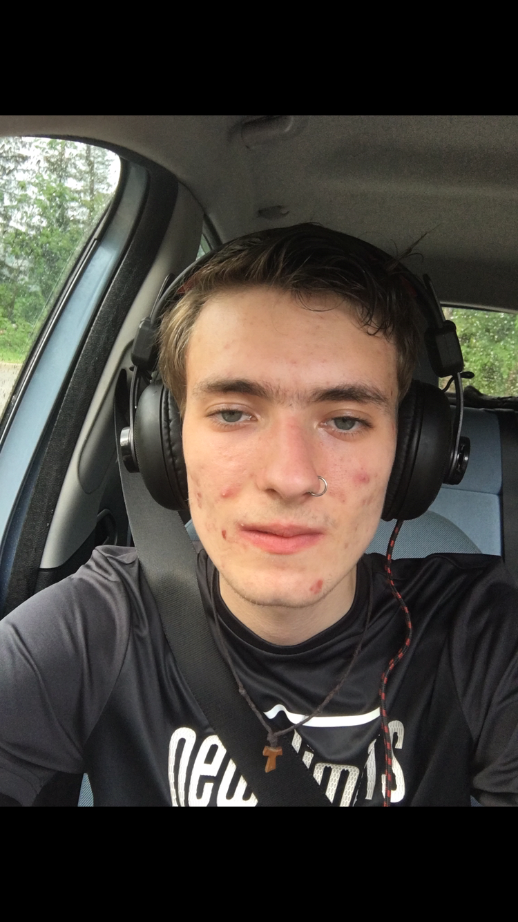 Steht mir dieses nasenpiercing-? (Bilder)? (Aussehen, Attraktivität