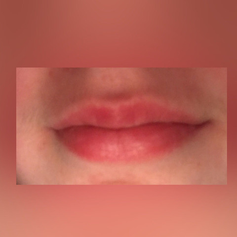 Meine Lippen  - (Gesundheit, Piercing, Schmuck)