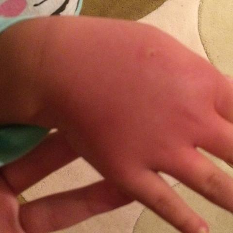 Stich An Der Hand Stich An Der Hand