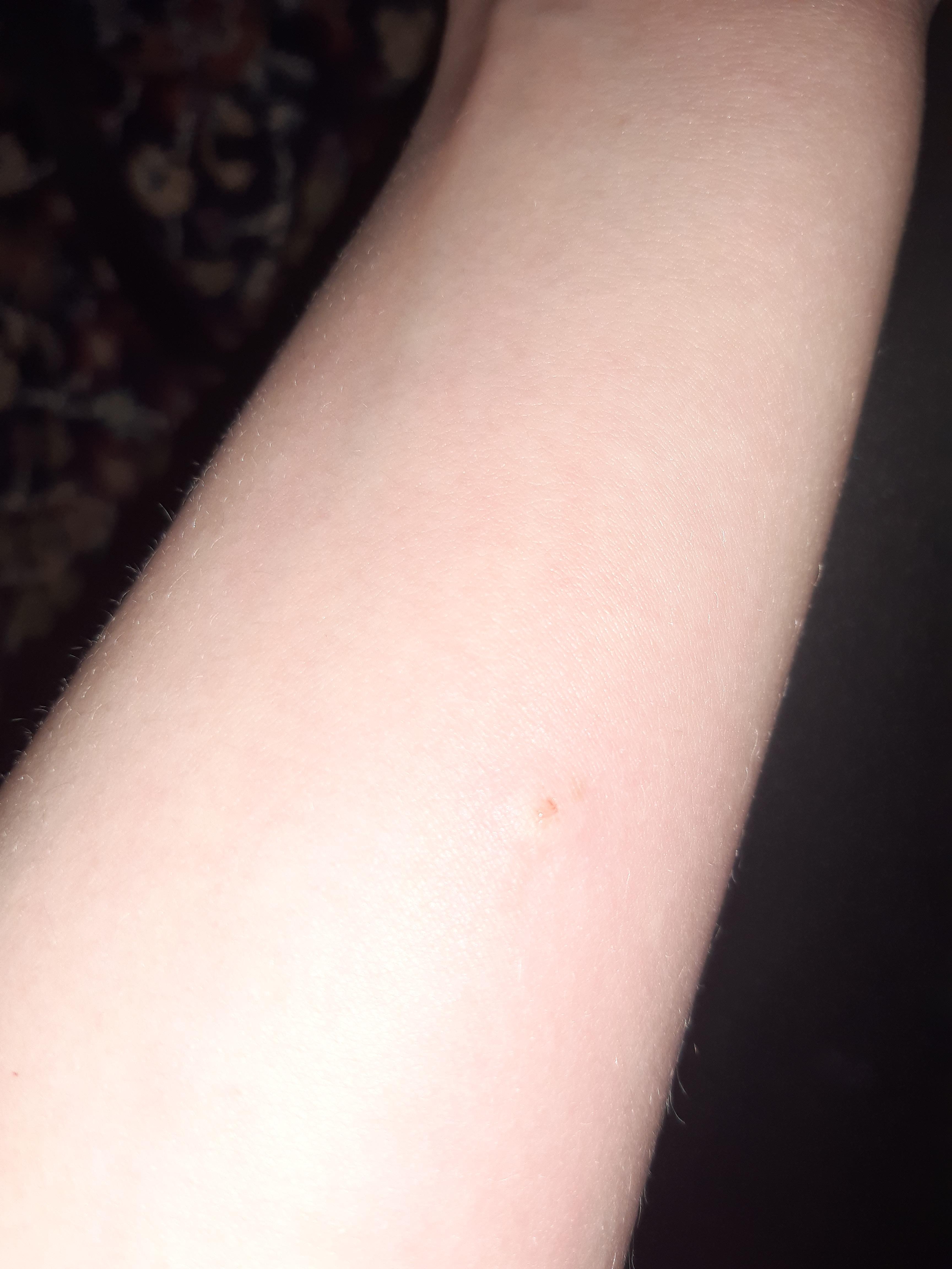 Stich Im Winter Stich Im Winter