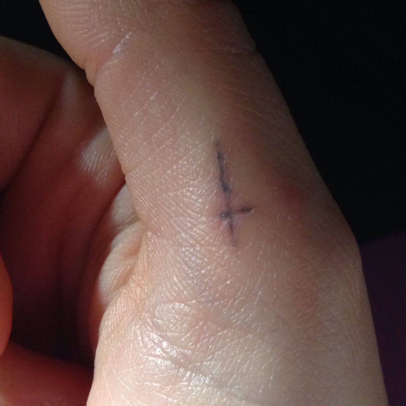 Stick and Poke Was schief gegangen? (Tipps, Ideen, Tattoo)