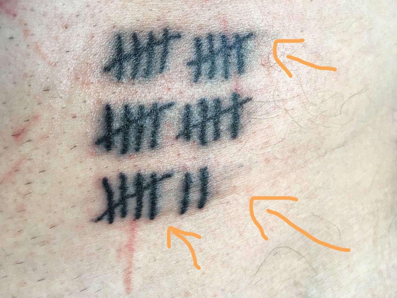 Stick and Poke Tattoo zu tief gestochen? (Tattoostudio, Tätowierer)