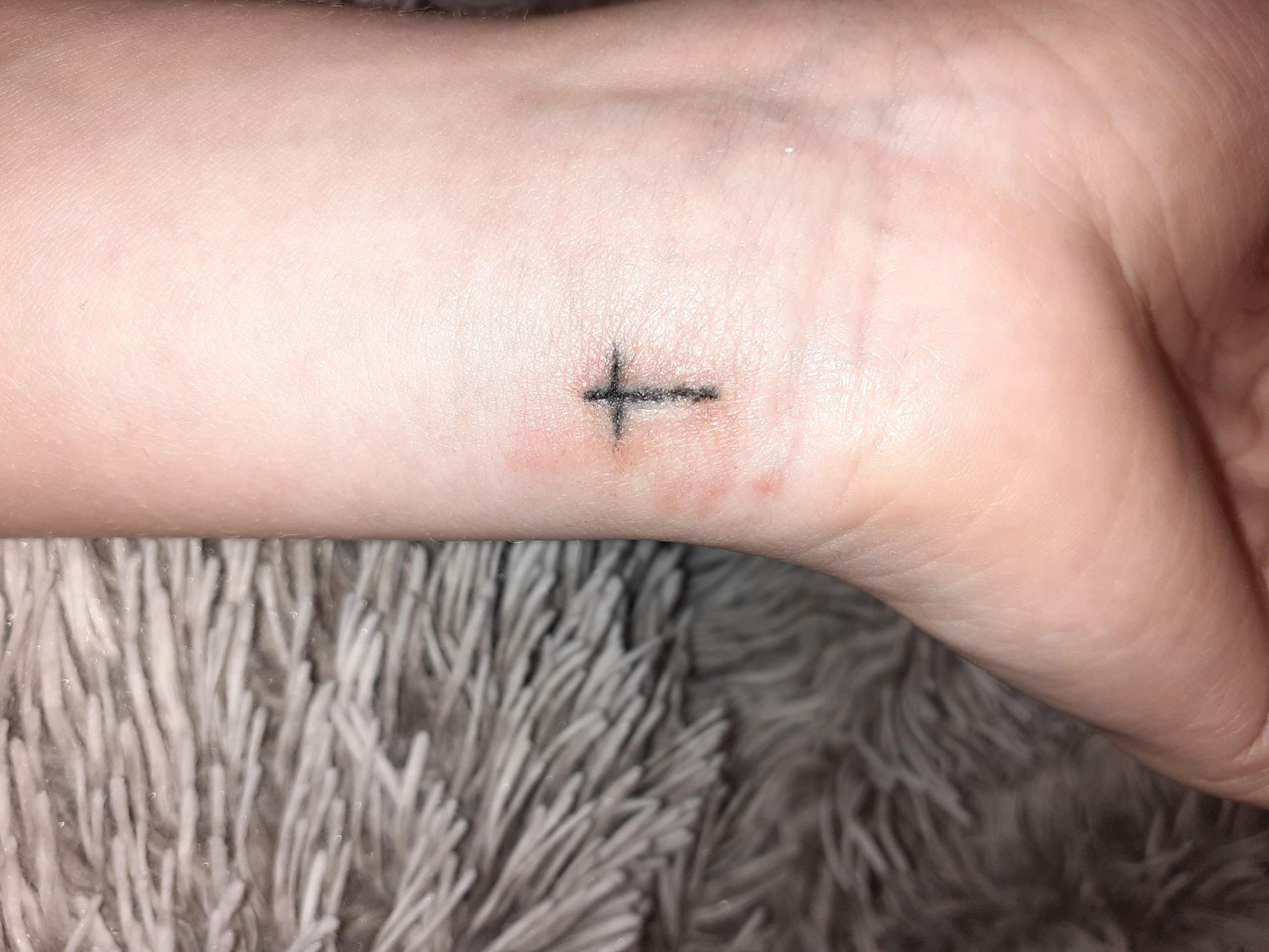 Stick n Poke Tattoo nach 1 Tag entzündet? (Entzündung)