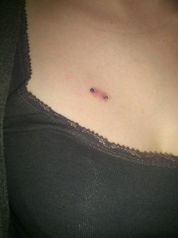 Surface Piercing An Der Brust Entzundet Was Tun Entzundung Surface Piercing An Der Brust Entzundet Was Tun Entzundung