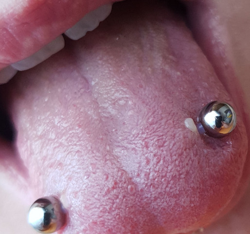 - (Zungenpiercing, Surace)