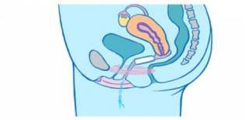 Wie Kriege Ich Den Tampon Ganz Rein Periode Wie Kriege Ich Den Tampon Ganz Rein Periode